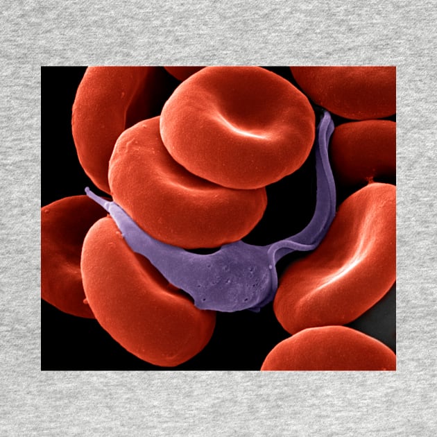 Trypanosome amongst blood cells, SEM (C021/7271) by SciencePhoto